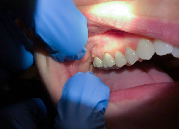 Best Orthodontic Emergency Dentist in Galesburg, IL